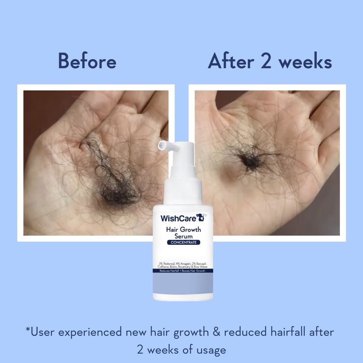 Wishcare Hair Growth Serum Concentrate In-Vivo Tested Redensyl, Anagain, Biotin,Keratin & Rice Water (20ml)