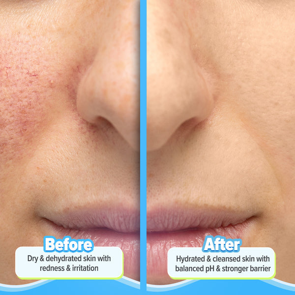 Aqualogica 5 Barrier+ Repair Gentle Cleanser with Avocado & 5 Essential Ceramides - 100 ml