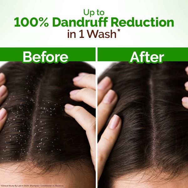 Mamaearth Lemon Anti-Dandruff Shampoo with Lemon & Aloe Vera for Itchy & Flaky Scalp - 250ml