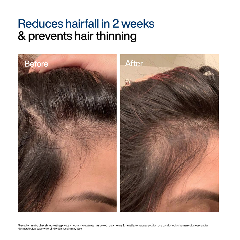 Wishcare Hair Growth Serum Concentrate Roll-On | 30ml