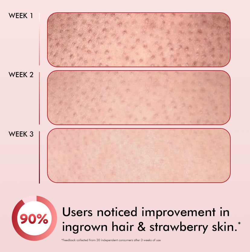 Mcaffeine 11% AHA BHA Strawberry Body Lotion for Skin Smoothening