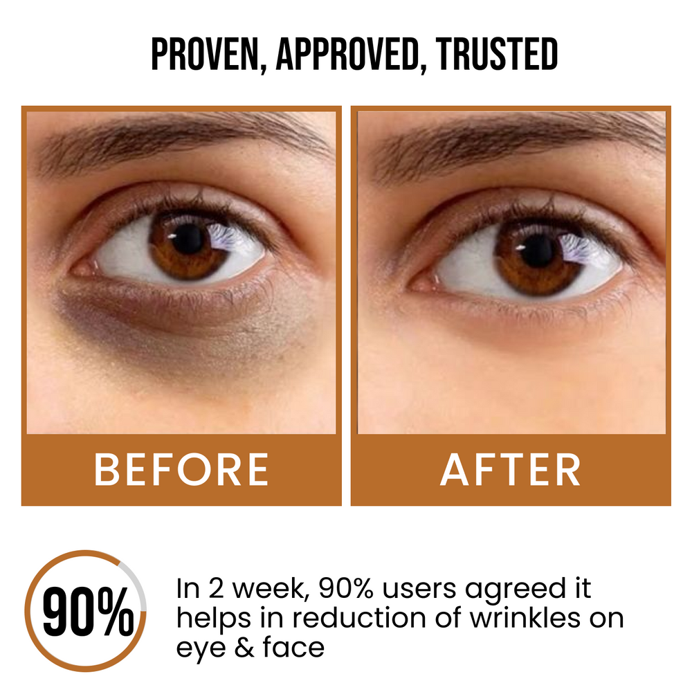 Insight cosmetics Dark Circle & Spot Reduction Face Serum