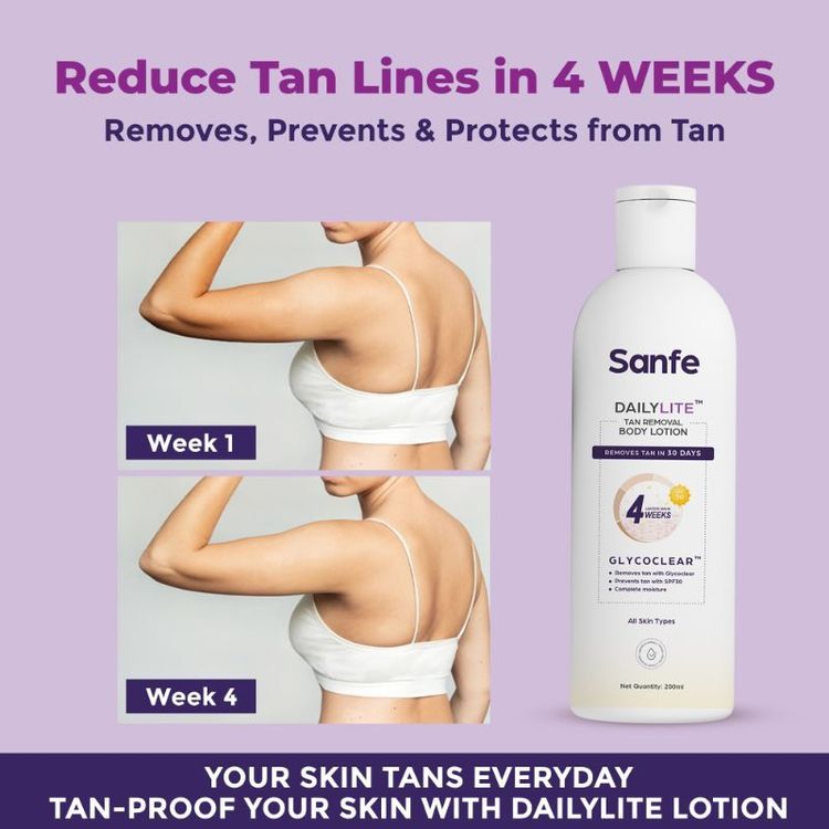 Sanfe Dailylite Tan Removal Body Lotion For Women Remove Tan With SPF 30 Body Moisturizer Cream
(200 ml)