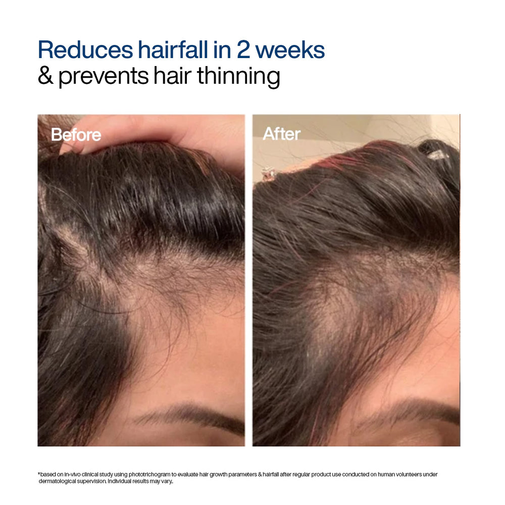 Wishcare Advanced Hair Growth Foaming Serum / 50g