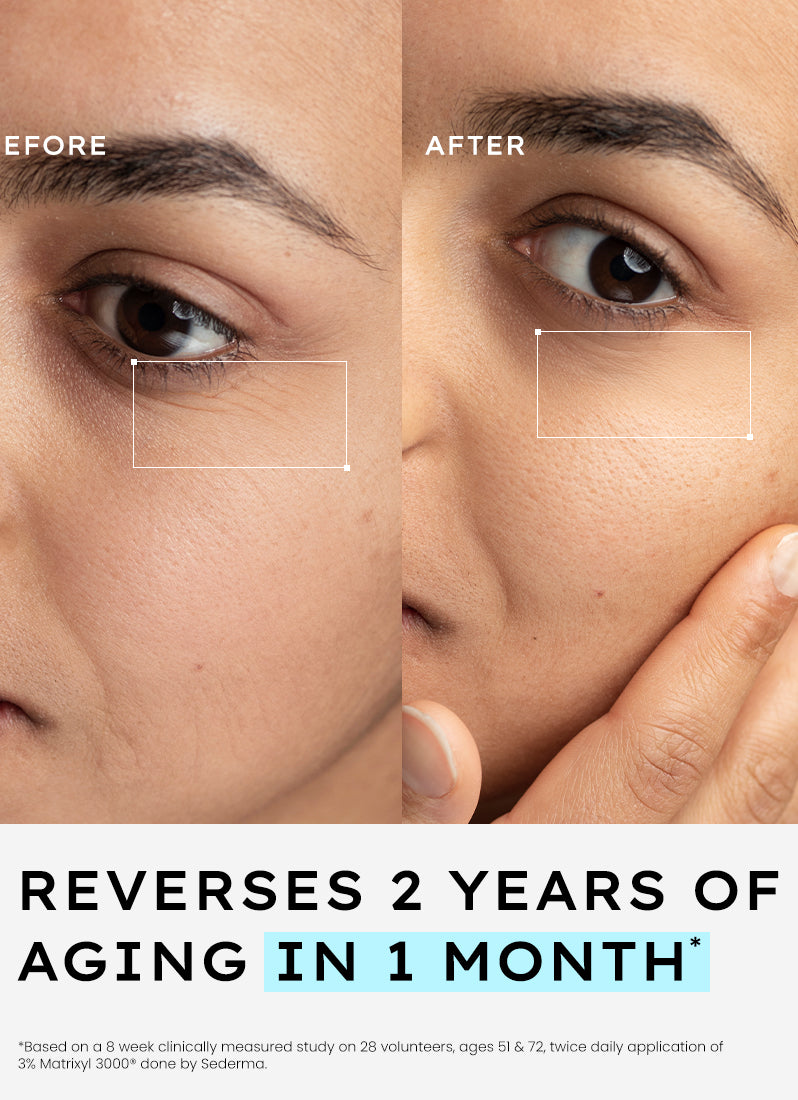 Hyphen 10% peptide with 2% copper peptide face serum | 30ml