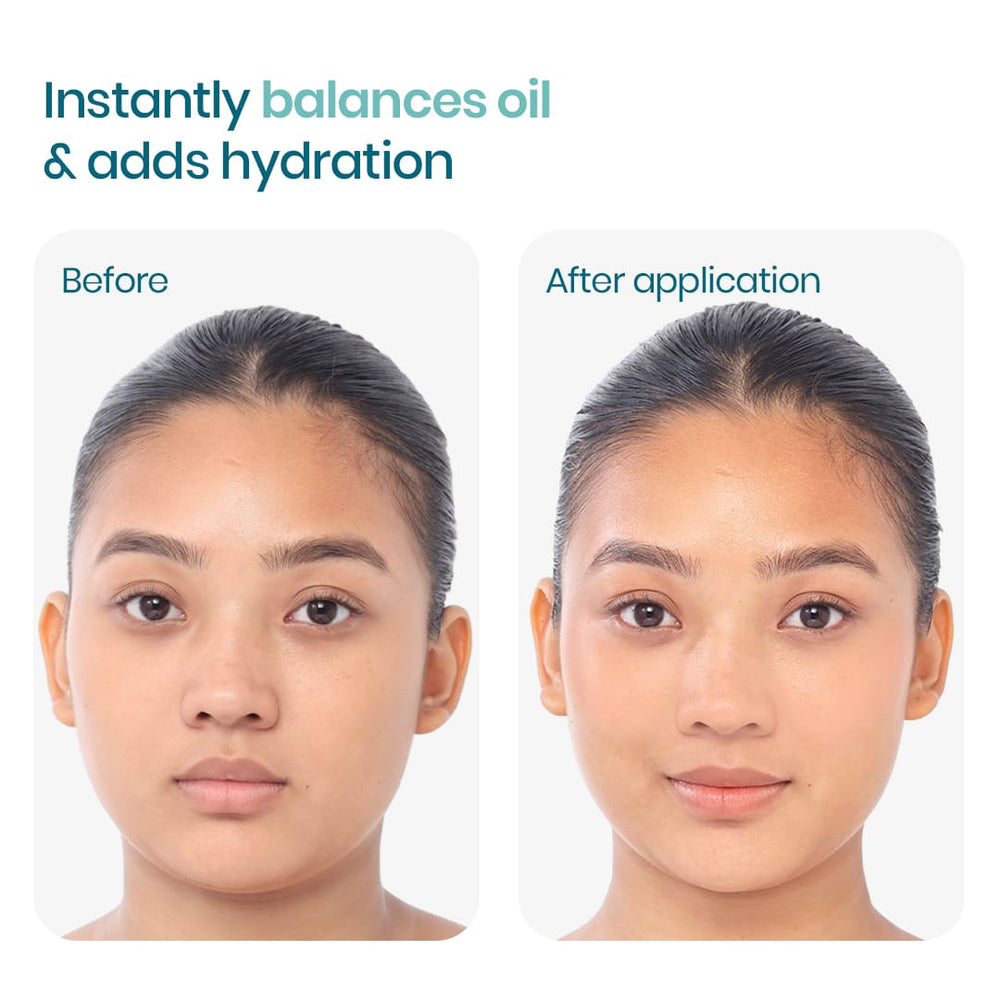 Wishcare 2:1:3 NMF Water Gel Moisturizer
