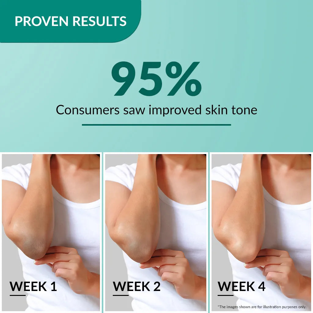 Fixderma Nigrifix Cream | A patented solution to treat hyperpigmentation