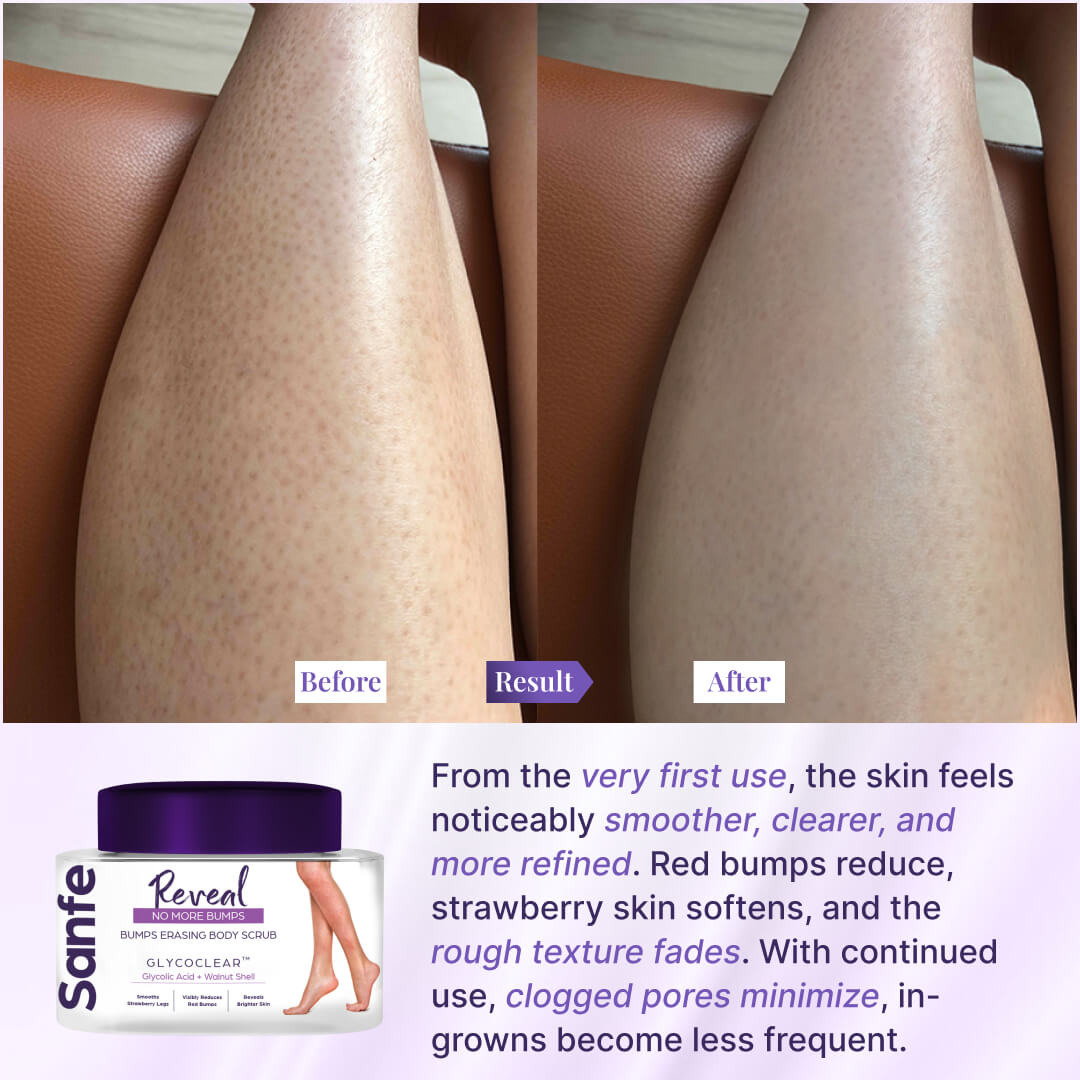 Sanfe Bumps Erasing Body Scrub