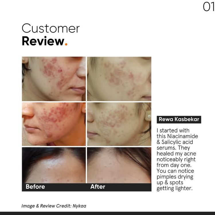 Minimalist 2% Salicylic Acid Face Serum For Blackheads & Whiteheads
(30ml)