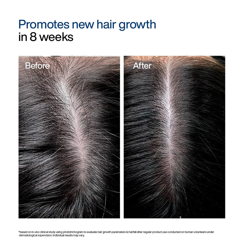 Wishcare Advanced Hair Growth Foaming Serum / 50g