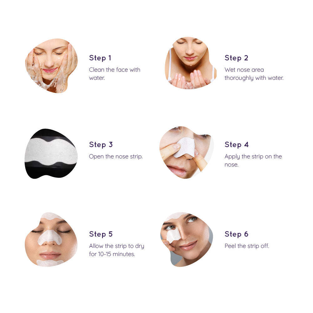 Sanfe Nose Strips - Pack of 6