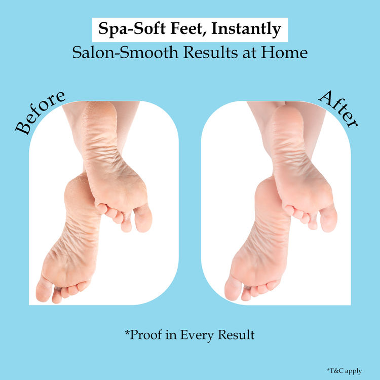 Sanfe Home Foot Spa & Callus Care 8 Step Pedicure Kit
(66g)