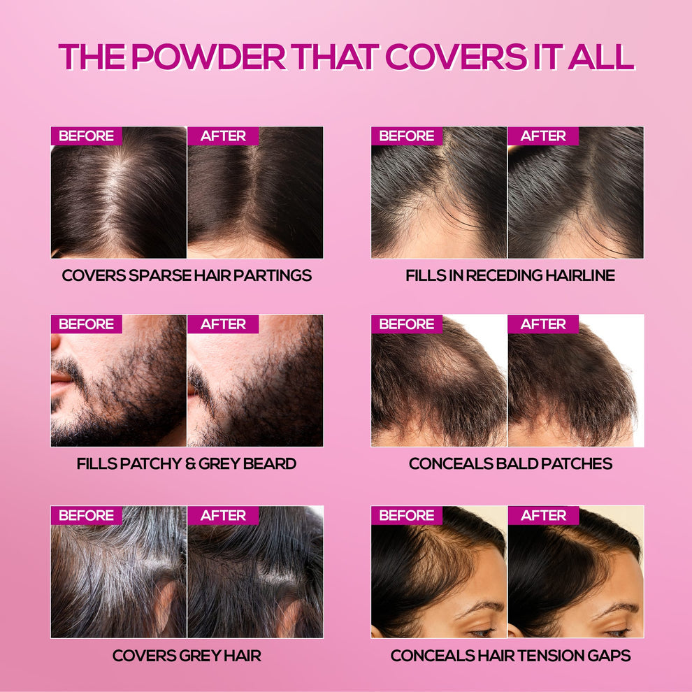 RENEE Cover Up Hair Powder- For Instant Grey Hair Coverage & Root Touch-Up (Brown)