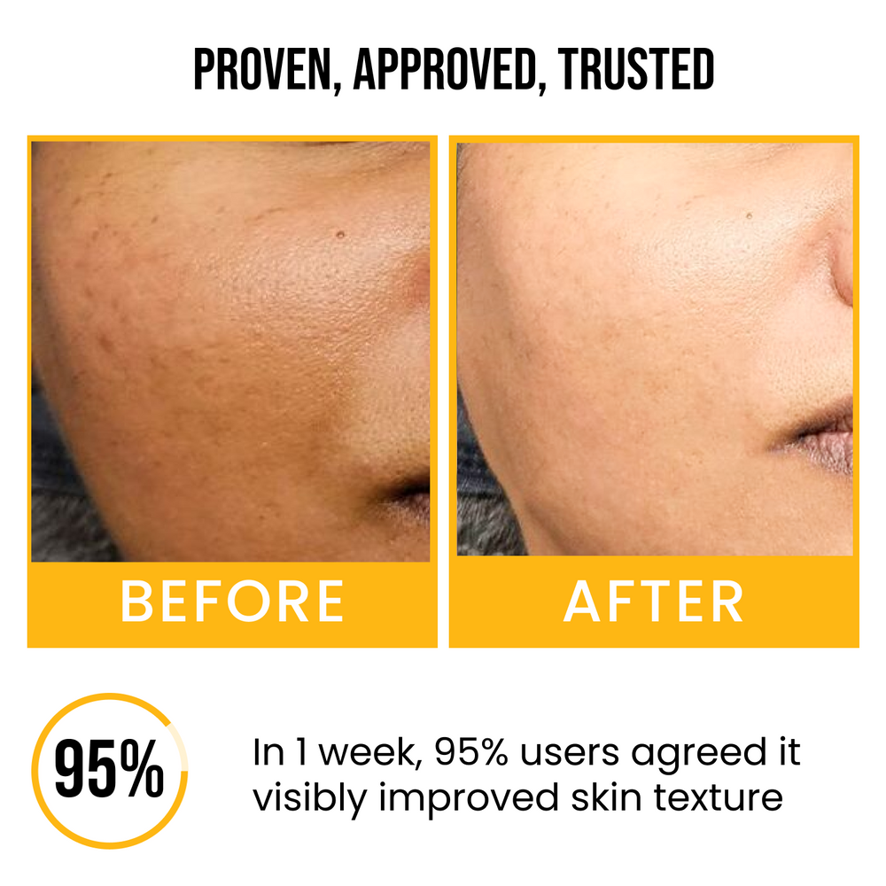 Insight cosmetics Tangerine Peel Clear Skin Face Serum