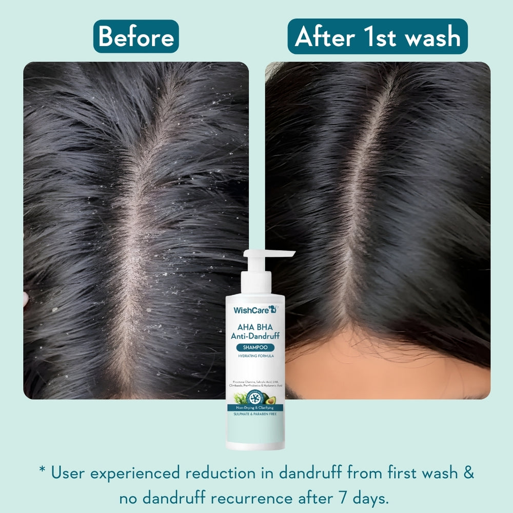 Wishcare AHA BHA Anti-Dandruff Shampoo
