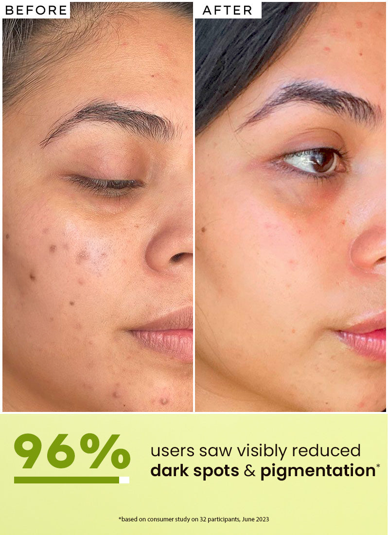 Hyphen Golden hour glow serum | 5% niacinamide, 1% alpha arbutin- 30 ml