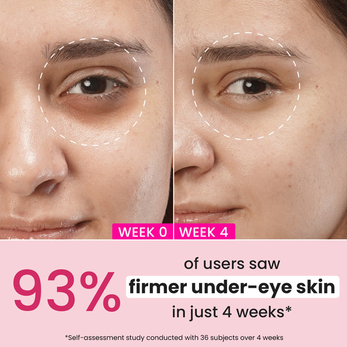 Dot & Key Pomegranate + Retinol Eye Cream for Dark Circles(20ml)