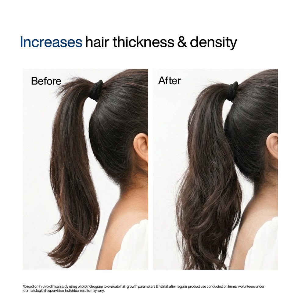 Wishcare Hair Growth Serum Concentrate Roll-On | 30ml