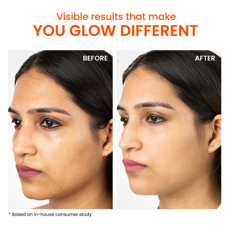 Foxtale SPF 50 Aqua-Gel Lightweight Sunscreen for Oily Skin, In-Vivo Tested PA++++, Matte Finish.
(50g)