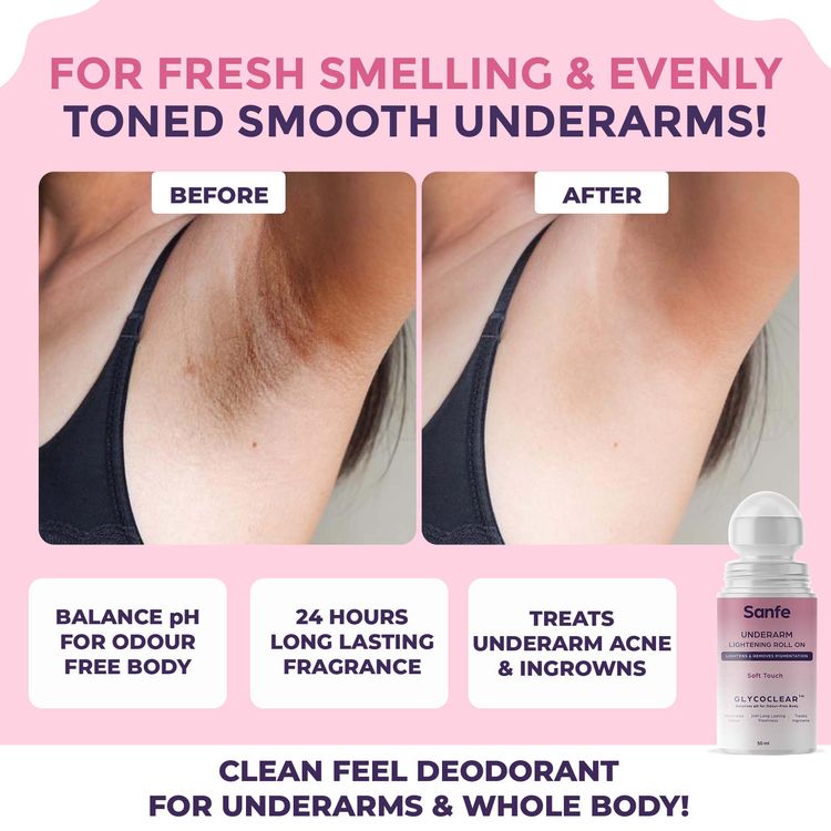 Sanfe Underarm Lightening Roll On (Soft Touch) with 5% AHA
(50ml)