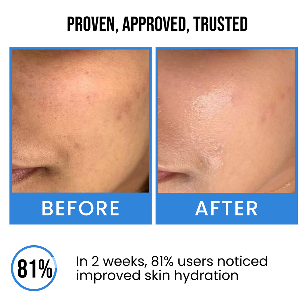 Insight cosmetics Ultra Hydrating Face Serum