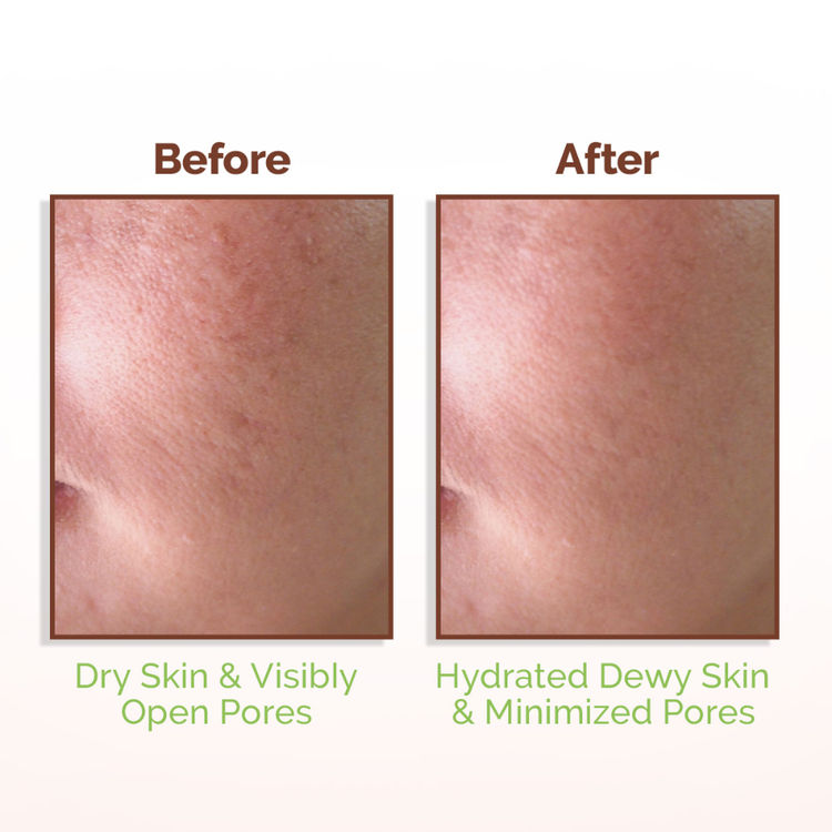 Mamaearth Rice Water Dewy Face Toner with 4% Niacinamide for Glass Skin and All Skin Types (150ml)