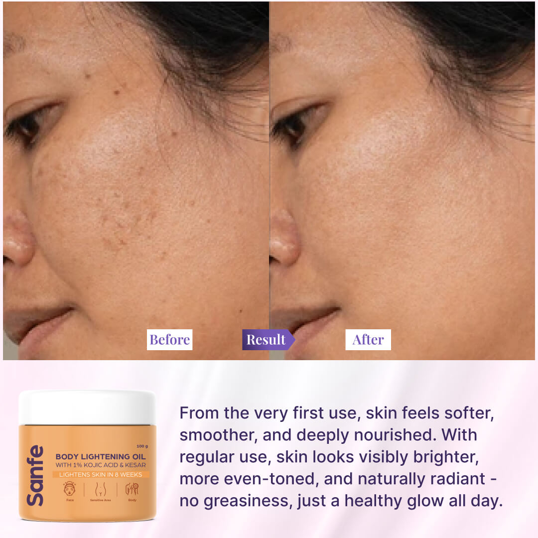 Sanfe Body Lightening Oil - 100gm