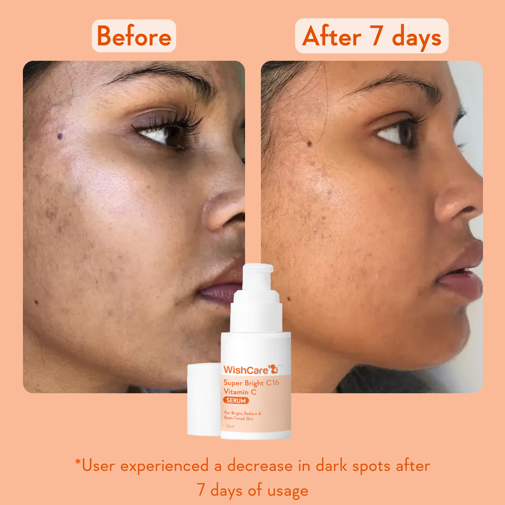 Wishcare Super Bright Vitamin C16 Serum