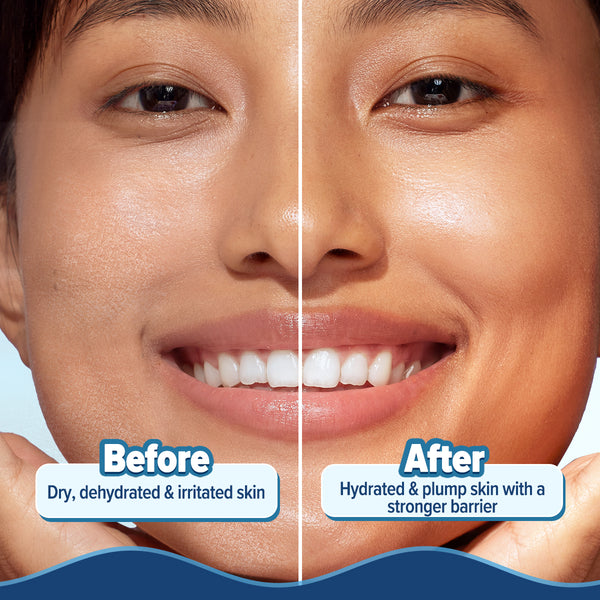 Aqualogica 5 Barrier+ Hydra Gel Moisturizer with Avocado & 5 Essential Ceramides - 100 g