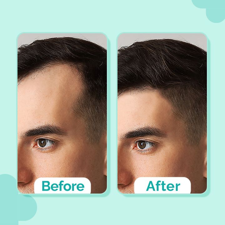 The Derma Co 20% Actives Peptide-Stem Cell Hair Growth Serum with Foligen Analupe & Anagain For Hair Growth - 30 ml