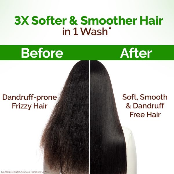 Mamaearth Lemon Anti-Dandruff Conditioner with Lemon & Aloe Vera for Itchy & Flaky Scalp - 250 ml