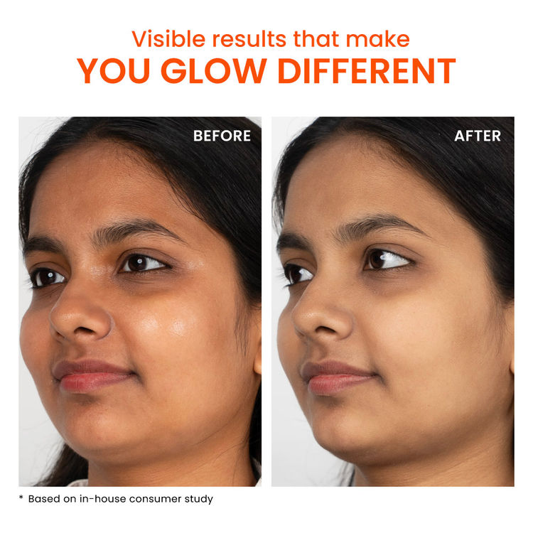 Foxtale SPF 50 Aqua-Gel Lightweight Sunscreen for Oily Skin, In-Vivo Tested PA++++, Matte Finish.
(80g)