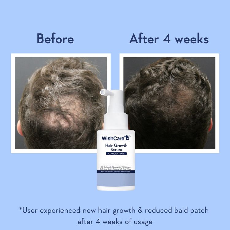 Wishcare Hair Growth Serum Concentrate In-Vivo Tested Redensyl, Anagain, Biotin,Keratin & Rice Water (20ml)