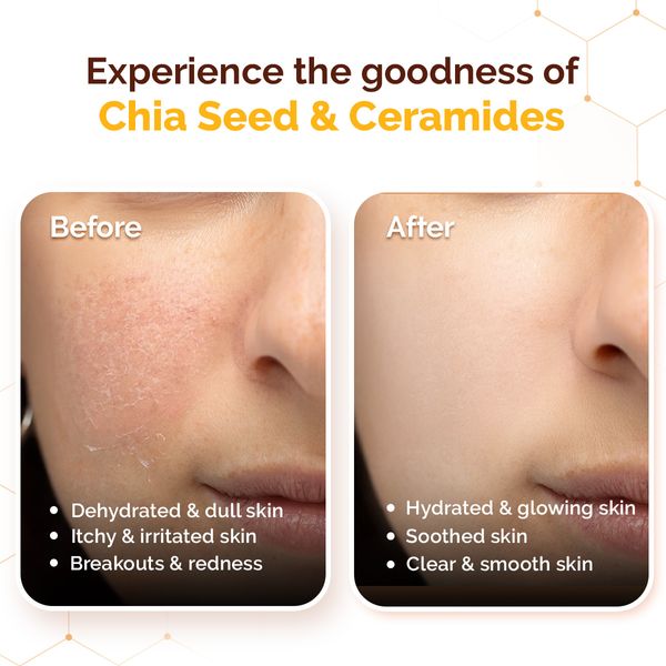Mamaearth Chia Calming Sunscreen with Chia Seed & Ceramides for Hydrated Glow & Sun Protection - 50 g