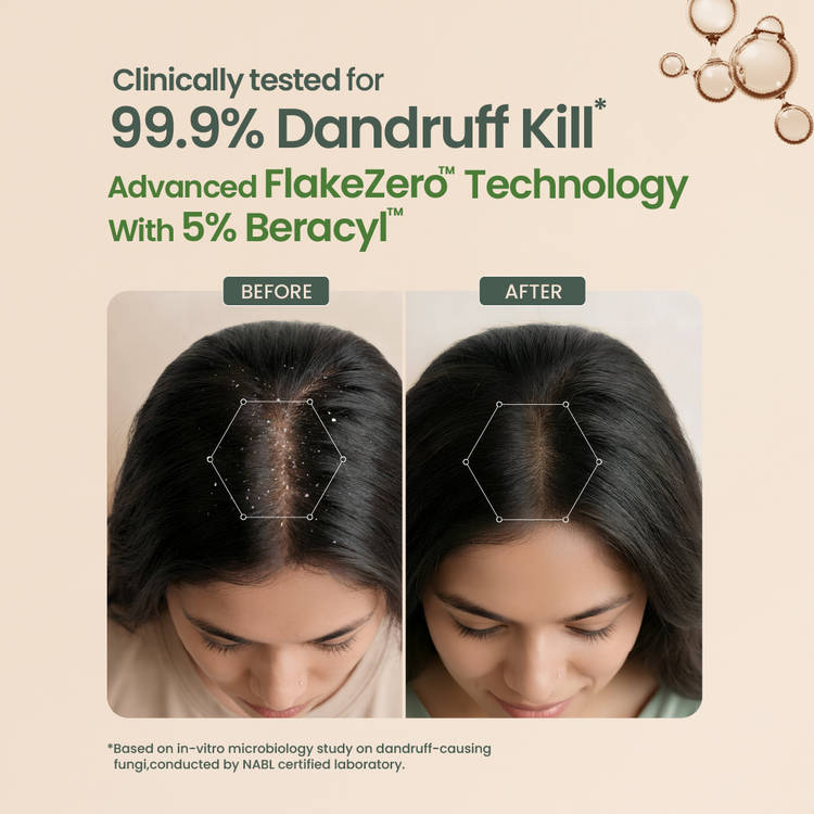 Nat Habit Anti-Dandruff Neem Beracyl Navdha Shampoo (225ml)