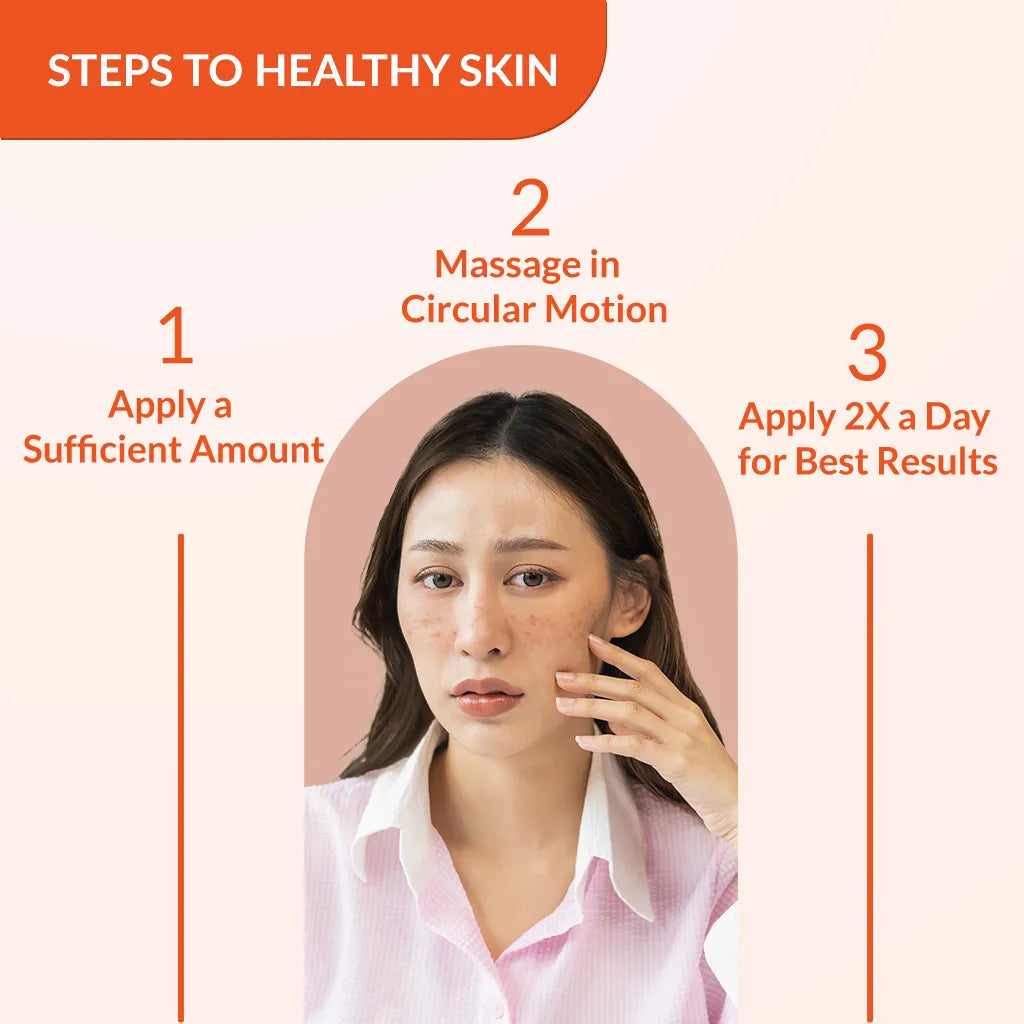 Fixderma Skarfix-TX Cream | Effective treatment for melasma and dark spots (15g)