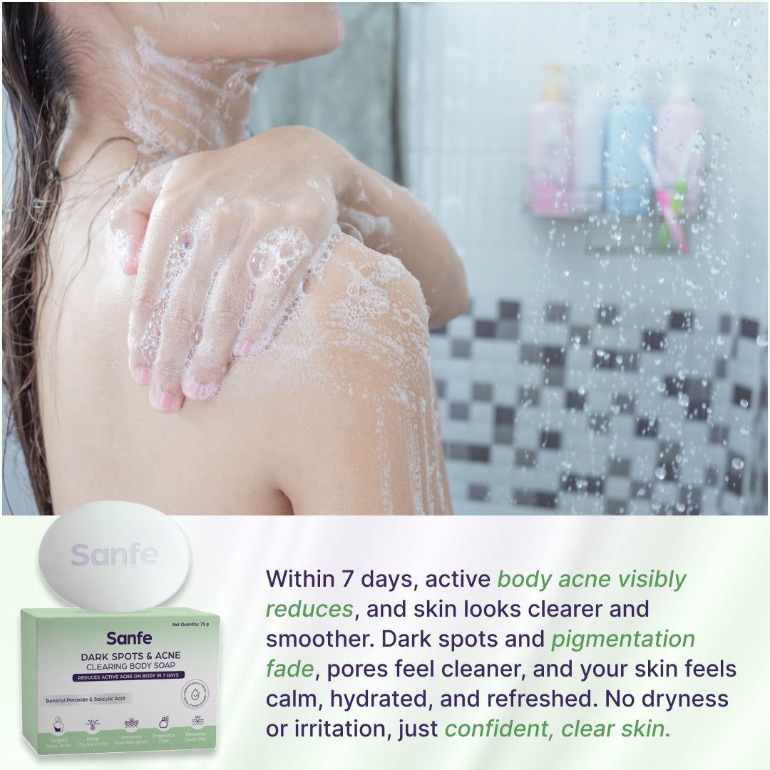 Sanfe Dark Spots & Acne Clearing Body Soap