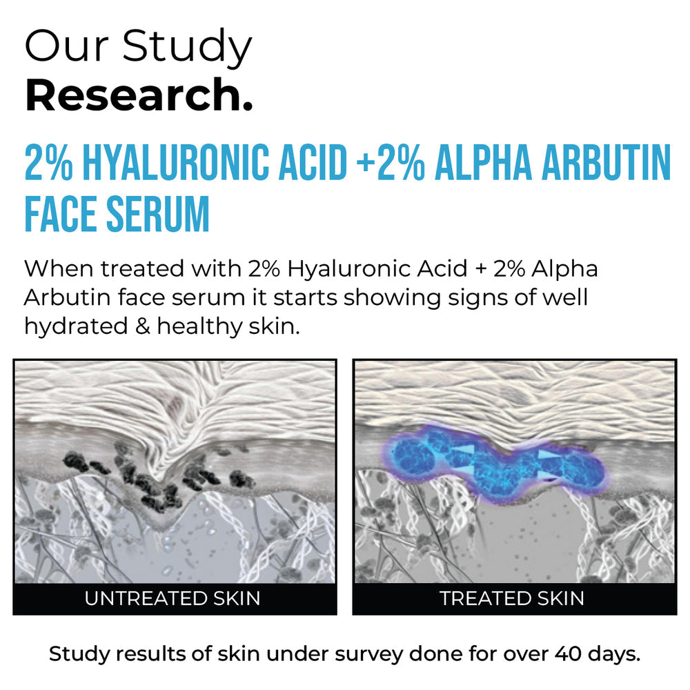 Insight cosmetics 2% Hyaluronic Acid + 2% Alpha Arbutin Face Serum