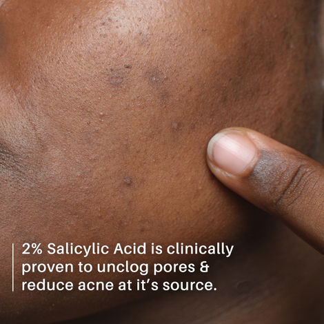 DERMDOC 2% Salicylic Acid Face Serum (15 ml)