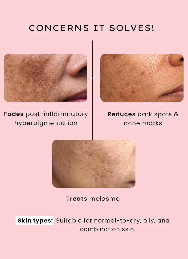 Hyphen Dual phase de-pigmentation serum | 4% tranexamic acid- 30ml