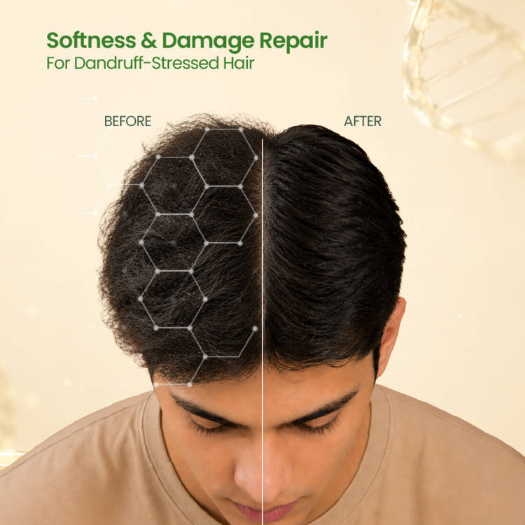 Nat Habit Anti-Dandruff Neem Green Tea Conditioner (125ml)