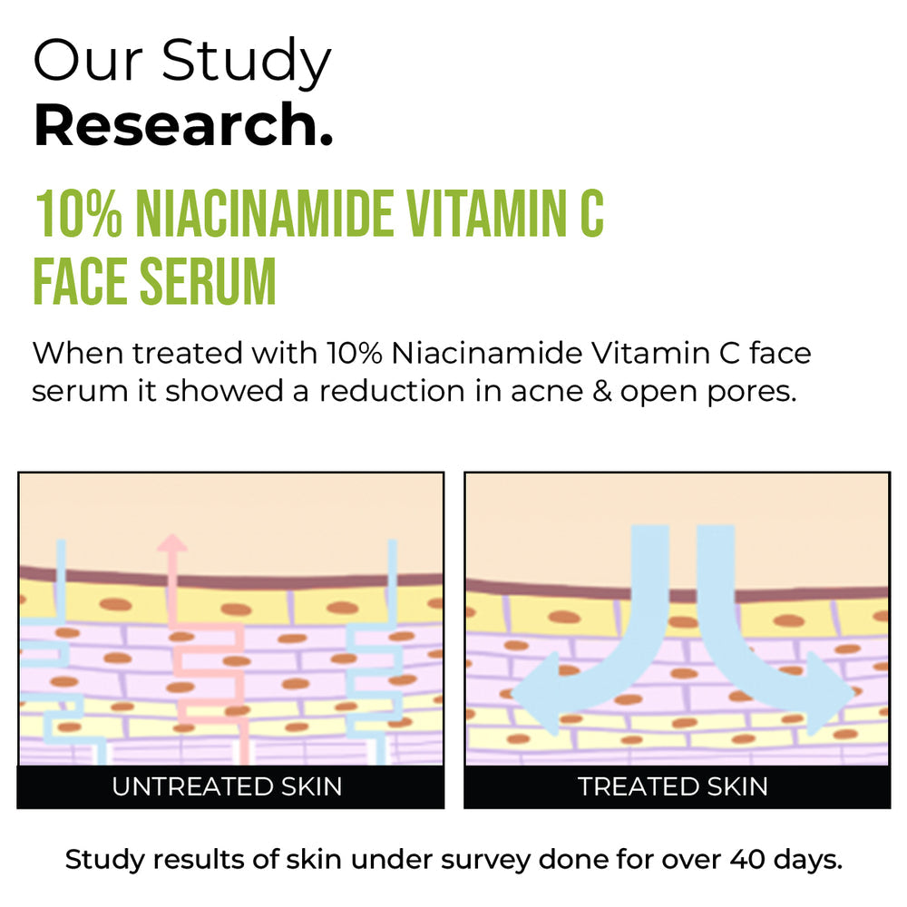 Insight cosmetics 10% Niacinamide Vitamin C Face Serum