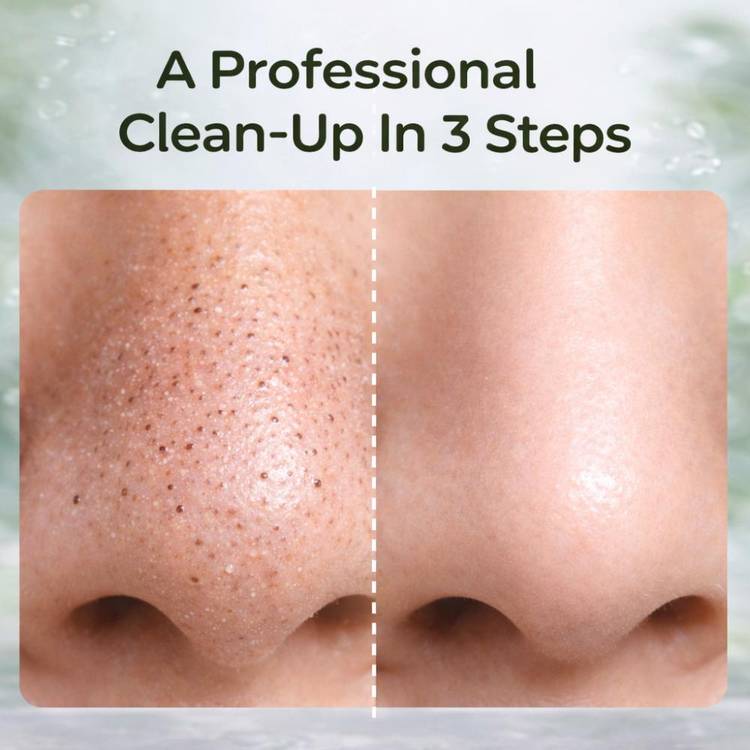 Sanfe Deepdetox 3-In-1 Nose Strips For Blackhead Removal (3pcs)