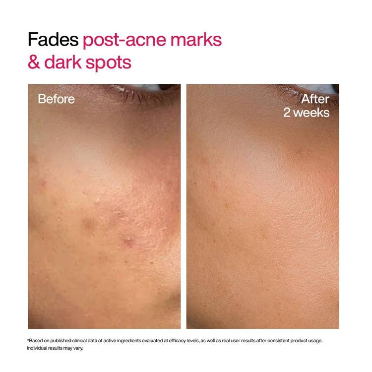 Wishcare Advanced Dark Spot Correcting Txa Shot Serum (30ml)