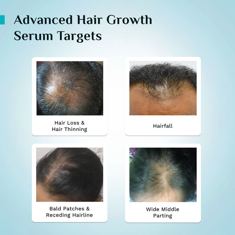 Pilgrim Advanced Hair Growth Serum Roll-On
(25ml)