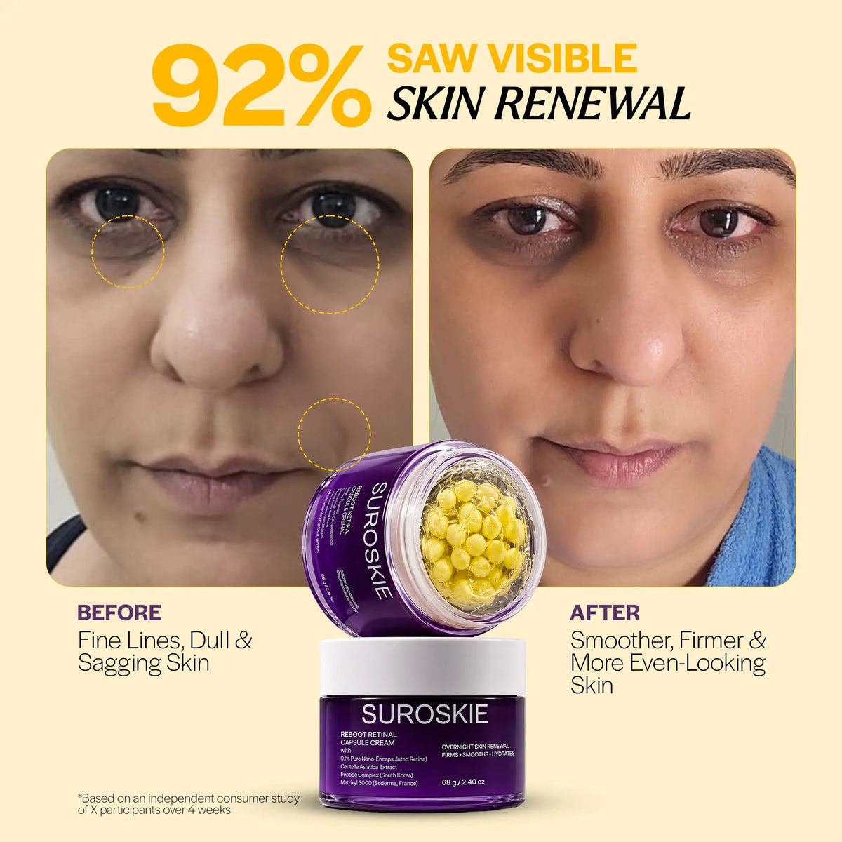 Suroskie Reboot Retinal Capsule Cream