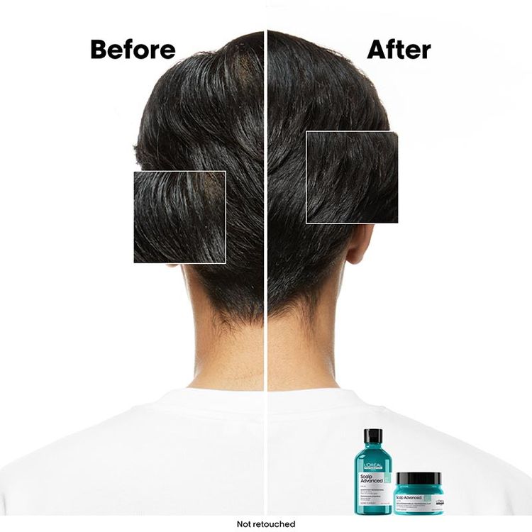 LOreal Professionnel Scalp Advanced Anti-Oiliness 2-In-1 Shampoo & Mask Deep Purifier Clay For Very Oily Scalp (250ml)
