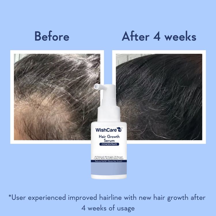 Wishcare Hair Growth Serum Concentrate In-Vivo Tested Redensyl, Anagain, Biotin,Keratin & Rice Water (20ml)