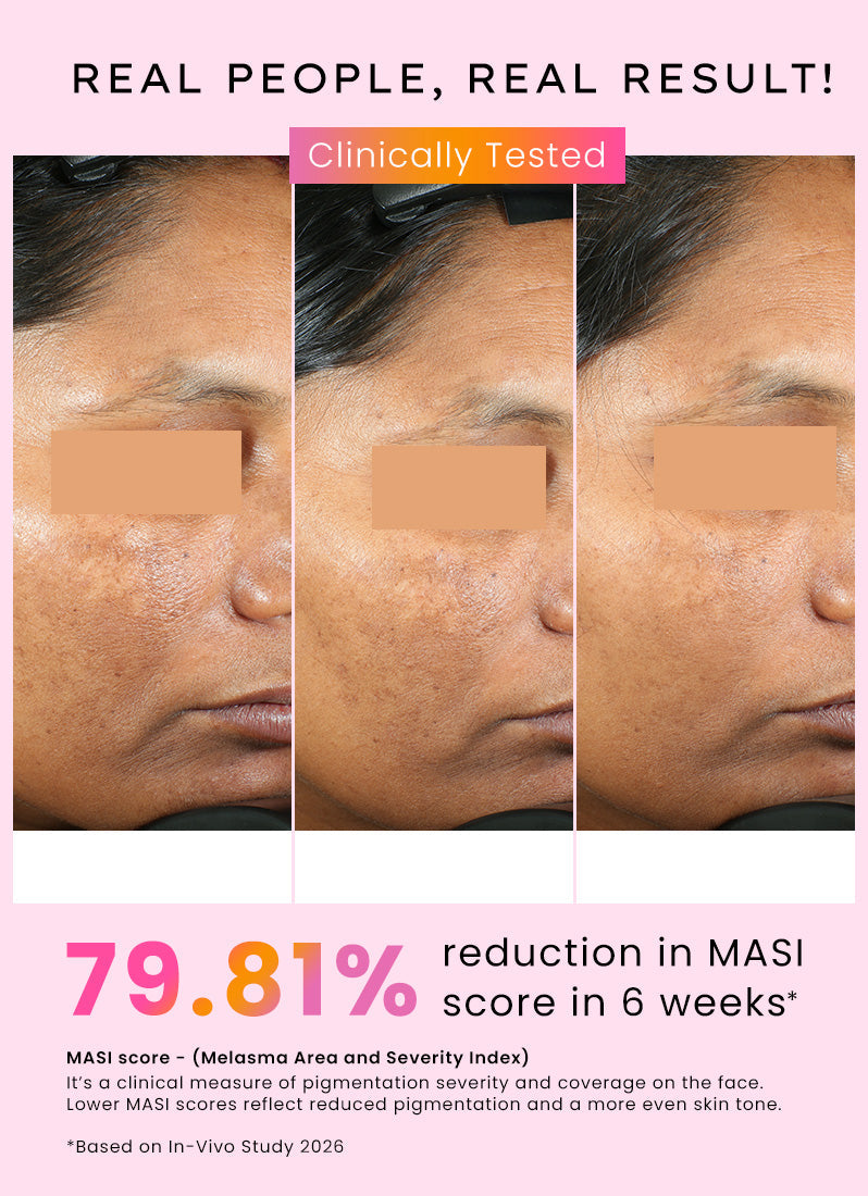 Hyphen Dual phase de-pigmentation serum | 4% tranexamic acid- 30ml