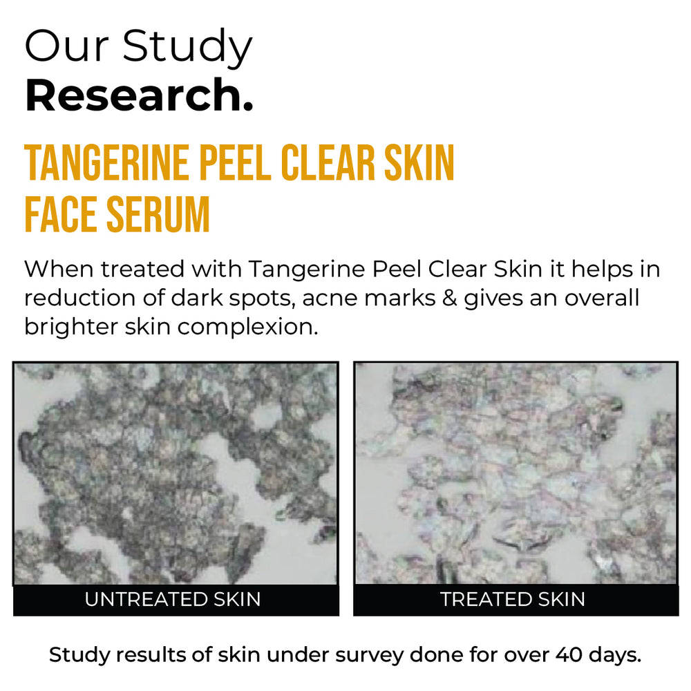Insight cosmetics Tangerine Peel Clear Skin Face Serum